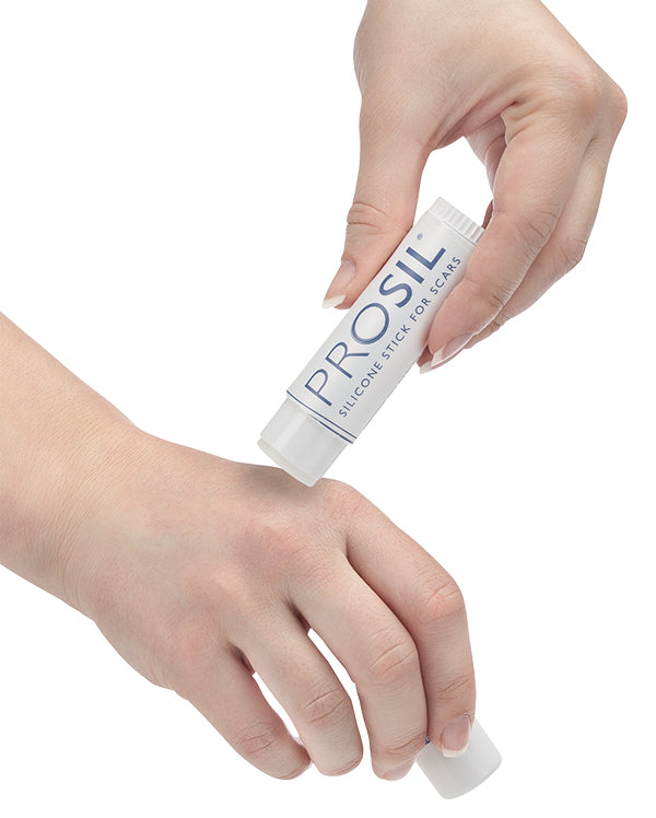 Woman applying Pro-Sil scar treatment on her hand