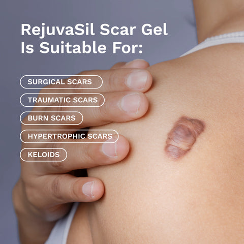 RejûvaSil Silicone Scar Gel 1 oz